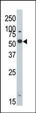 DYRK2 Antibody in Western Blot (WB)