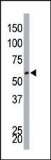 DYRK4 Antibody in Western Blot (WB)