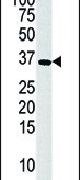 DGUOK Antibody in Western Blot (WB)