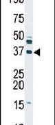 DGUOK Antibody in Western Blot (WB)