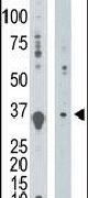 DGUOK Antibody in Western Blot (WB)