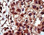 DGKI Antibody in Immunohistochemistry (IHC)