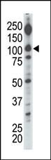 DGKI Antibody in Western Blot (WB)