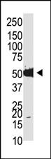 Dnmt2 Antibody in Western Blot (WB)