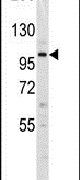 DNMT3A Antibody in Western Blot (WB)