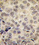 DNMT3B Antibody in Immunohistochemistry (IHC)