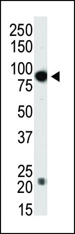 DNMT3B Antibody in Western Blot (WB)