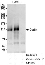Dorfin Antibody in Immunoprecipitation (IP)