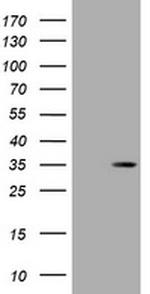 DsRed-Monomer Antibody in Western Blot (WB)