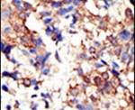 Ubiquilin 2 Antibody in Immunohistochemistry (IHC)