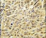 Ubiquilin 2 Antibody in Immunohistochemistry (IHC)