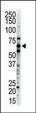 Ubiquilin 2 Antibody in Western Blot (WB)