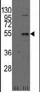 DTNBP1 Antibody in Western Blot (WB)