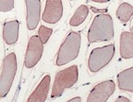 Dysferlin Antibody in Immunohistochemistry (IHC)