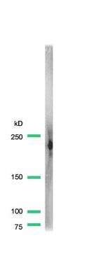 Dysferlin Antibody in Western Blot (WB)