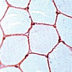 Dystrophin Polyclonal Antibody