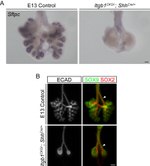 E-cadherin Antibody in Immunohistochemistry (Frozen) (IHC (F))