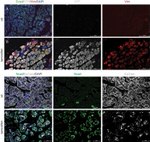 E-cadherin Antibody in Immunohistochemistry (IHC)