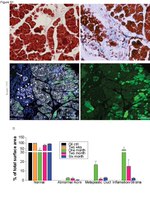 E-cadherin Antibody in Immunohistochemistry (IHC)