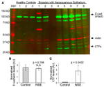 E-cadherin Antibody in Western Blot (WB)