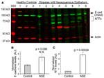 E-cadherin Antibody in Western Blot (WB)