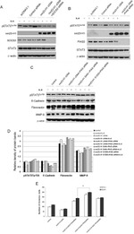 E-cadherin Antibody in Western Blot (WB)