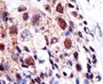 UBE2S Antibody in Immunohistochemistry (IHC)