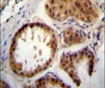 UBE2S Antibody in Immunohistochemistry (IHC)