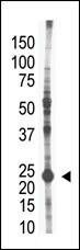 UBE2S Antibody in Western Blot (WB)