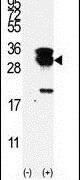 UBE2S Antibody in Western Blot (WB)