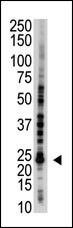 UBE2S Antibody in Western Blot (WB)