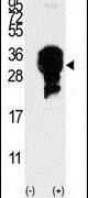 UBE2S Antibody in Western Blot (WB)