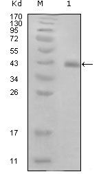 HPV Type 16 E7 Monoclonal Antibody (3D6F1)