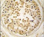 EARS2 Antibody in Immunohistochemistry (IHC)