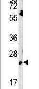 EBPL Antibody in Western Blot (WB)
