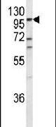 ECE1 Antibody in Western Blot (WB)