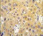 Thymidine Phosphorylase Antibody in Immunohistochemistry (IHC)