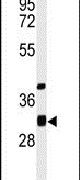 ECHDC1 Antibody in Western Blot (WB)