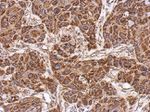 ECHDC1 Antibody in Immunohistochemistry (IHC)