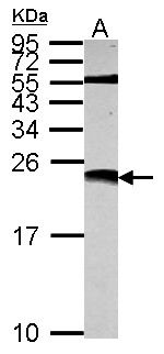 ECHDC1 Antibody in Western Blot (WB)