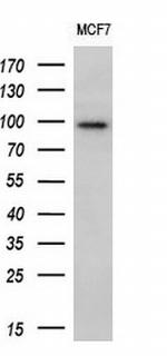ECT2 Antibody in Western Blot (WB)