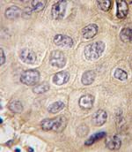 EDA Antibody in Immunohistochemistry (IHC)
