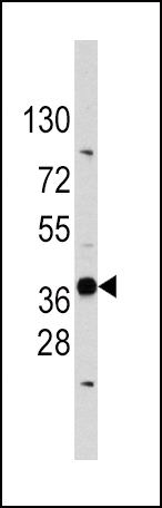 EDA Antibody in Western Blot (WB)