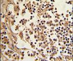 EEF1D Antibody in Immunohistochemistry (IHC)