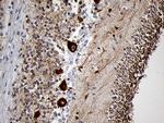 EEF1D Antibody in Immunohistochemistry (Paraffin) (IHC (P))