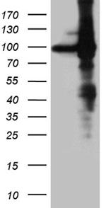 EEF1D Antibody in Western Blot (WB)