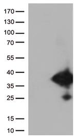 EFHD1 Antibody in Western Blot (WB)