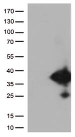 EFHD1 Antibody in Western Blot (WB)