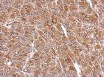 EFHD2 Antibody in Immunohistochemistry (IHC)