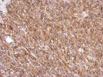 EFHD2 Antibody in Immunohistochemistry (IHC)